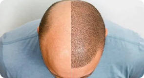 Lorem ipsum dolor sit